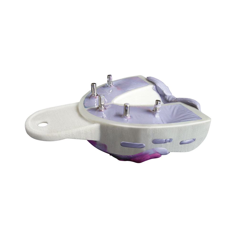Miratrays Implant Kit INTRO