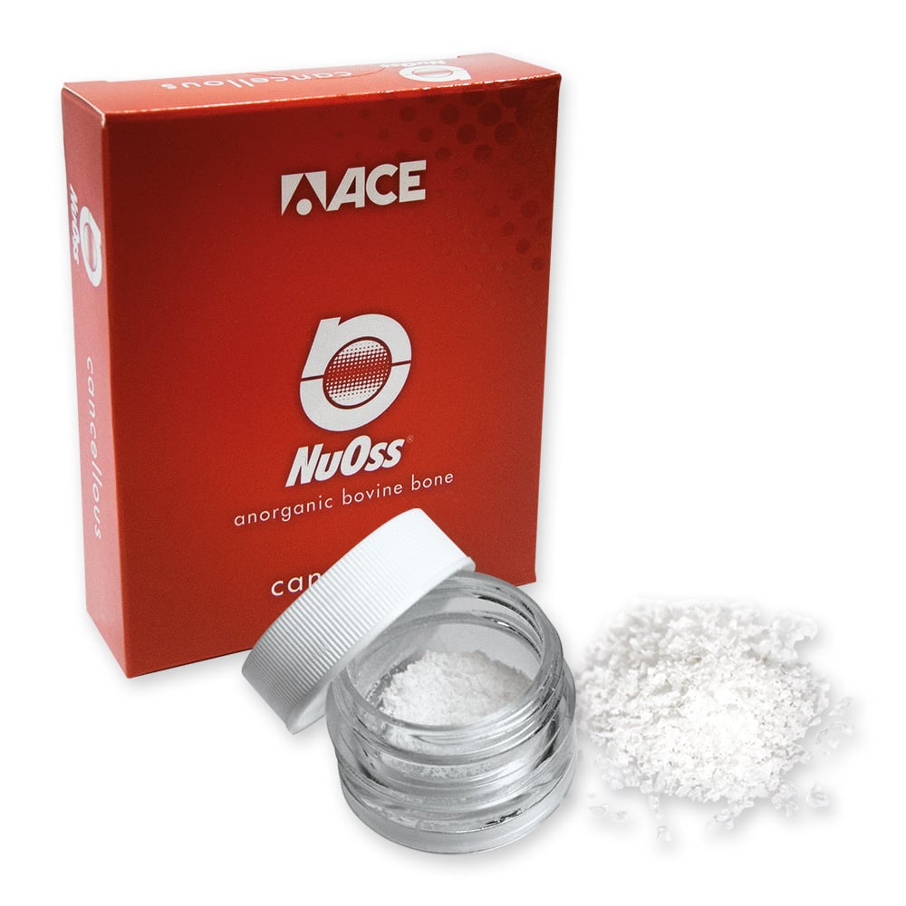 NuOss SPONGIEUX & CORTICAL GRANULES SUBSTITUT OSSEUX -
