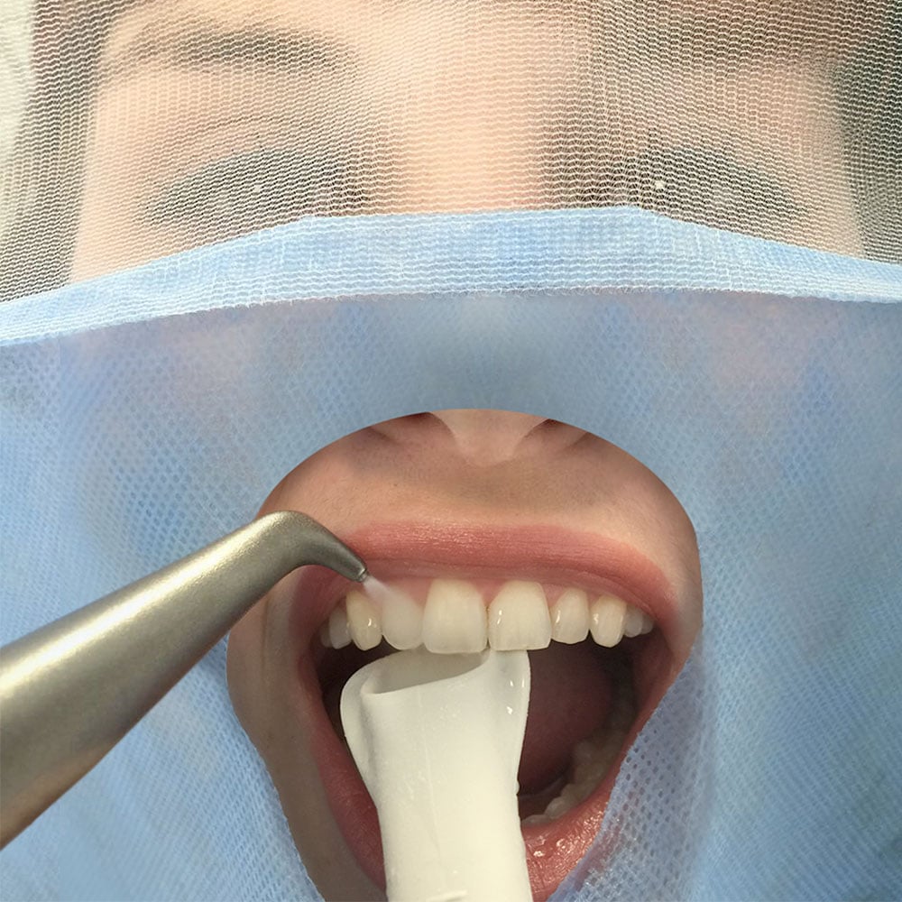 Safedrape champs faciaux jetables