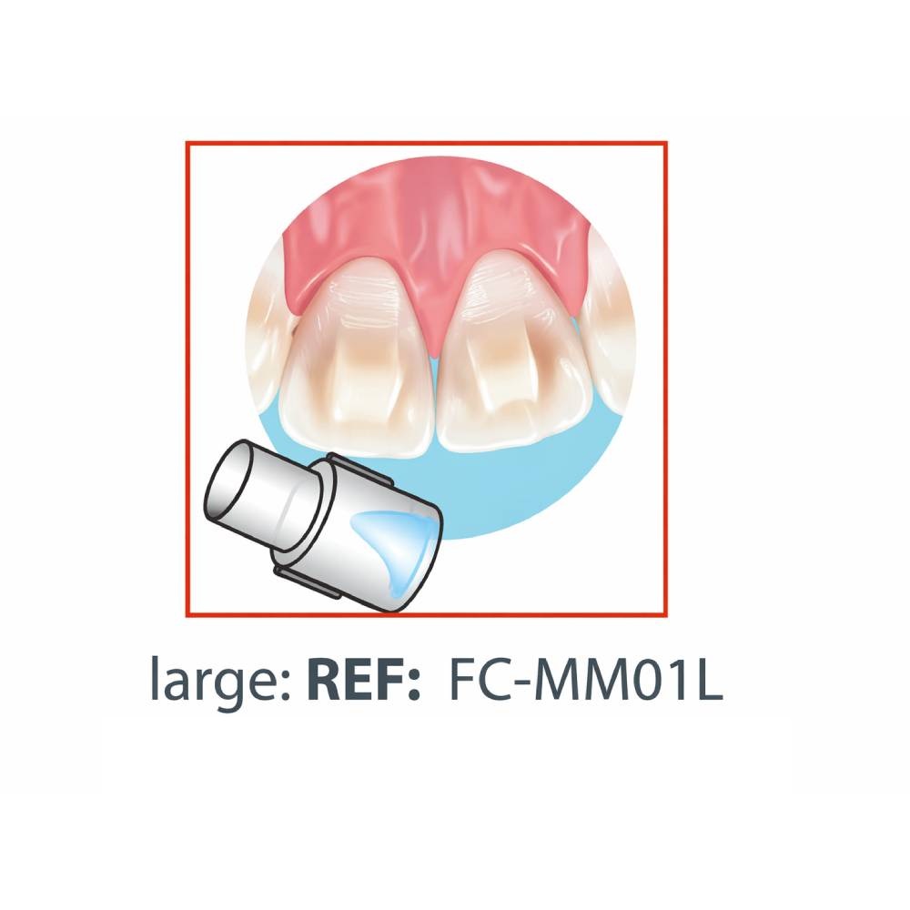 Mini Mold – Cale d’élévation (Bite Ramp) grand – lot de 10