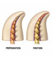 Miniature ProTaper Gold - blister de 6