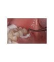 Miniature Celtra Duo HT A1 C14