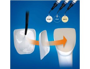 Bifix Veneer