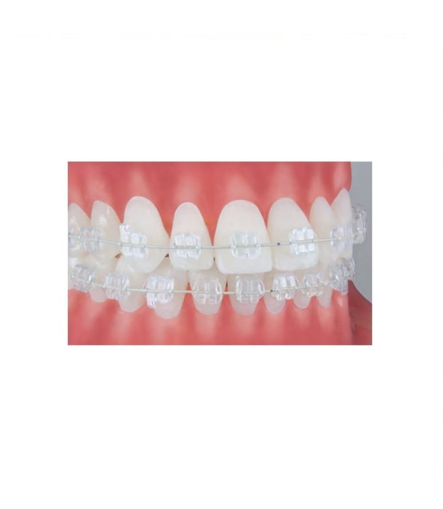Bracket Relection Roth Prem L Crochet 022 (10) OT