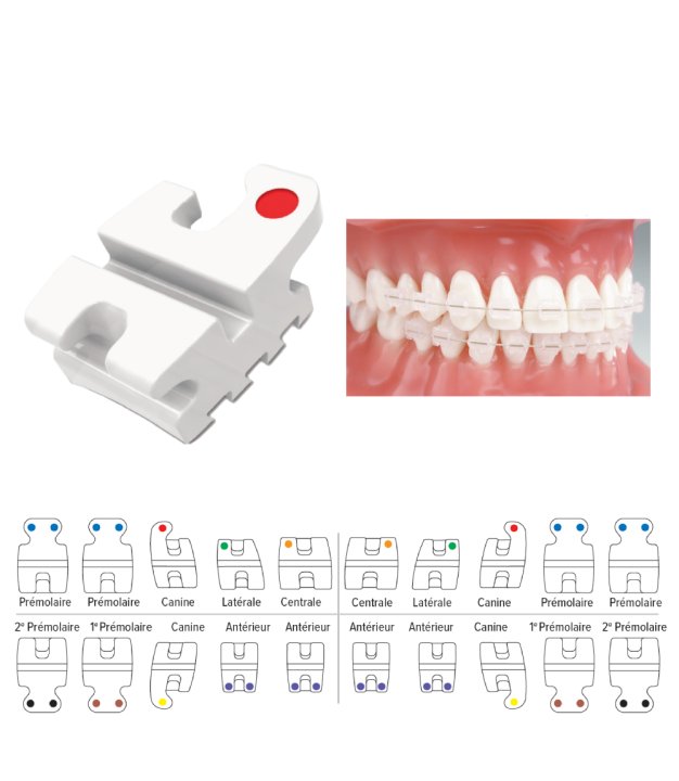 Brackets Mandibulaire Reflection Methode MBT