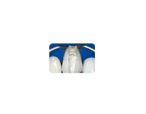 Matrices Cervicales Transparentes Hawe