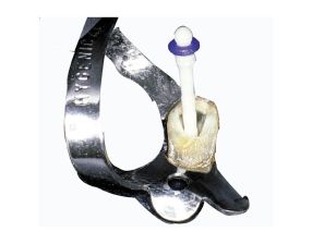 PARAPOST FIBER WHITE KIT INTRO PF-160      COLTENE