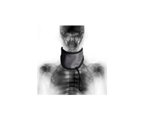 Protège thyroïde adulte TSSL
