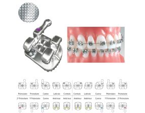 Brackets Maxillaires Pinnacle Méthode Roth