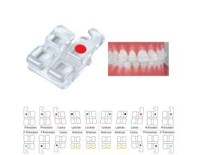 Brackets Maxillaires Pure Methode MBT (Recharge)