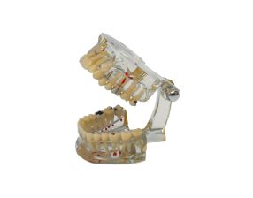 Modèle d'étude transparent Study Model