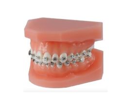 Modèle de démonstration orthodontique M51
